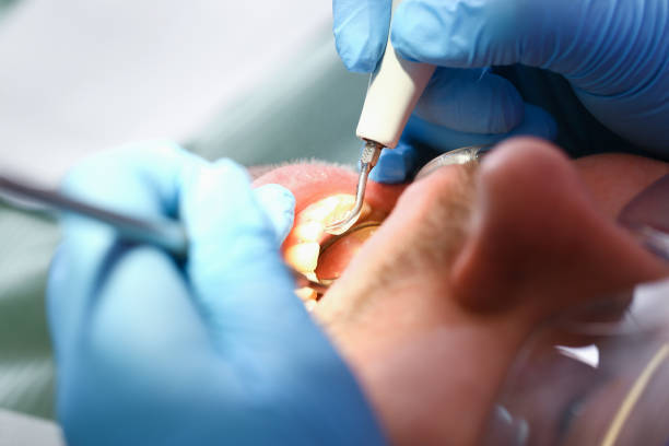 Best Emergency Tooth Extraction in Nanticoke, PA
